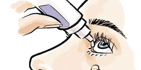 طول درمان جراحی پلک و استفاده از قطره چشمی